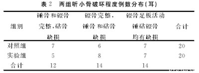 自体乳突骨皮质在开放式鼓室成形术中的应用,乳突根治术和鼓室成形术在正常情况下会降低听力吗