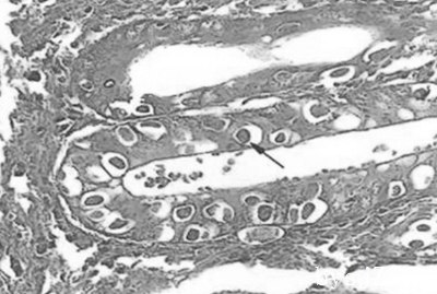 裂殖子和裂殖体形状图片