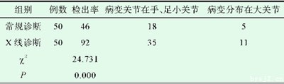 痛风性关节炎患者临床诊断中影像技术的运用,前列腺结石有害吗？非常感谢！