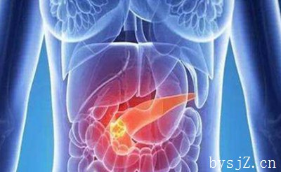 胰腺癌手术治疗复发影响因素讨论与结论,胰腺癌能在术后3个月内复发而不扩散吗？