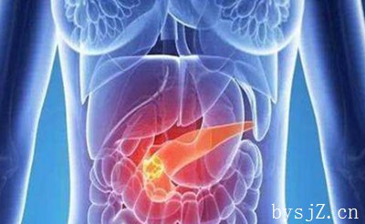 胰腺癌手术治疗复发影响因素