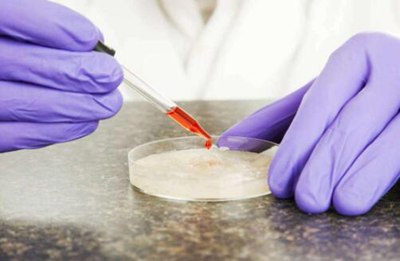 道路交通事故中碰撞伤的特征和判定分析,交通事故中轻伤的概念