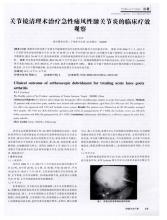 中医治疗急性痛风性关节炎的疗效分析