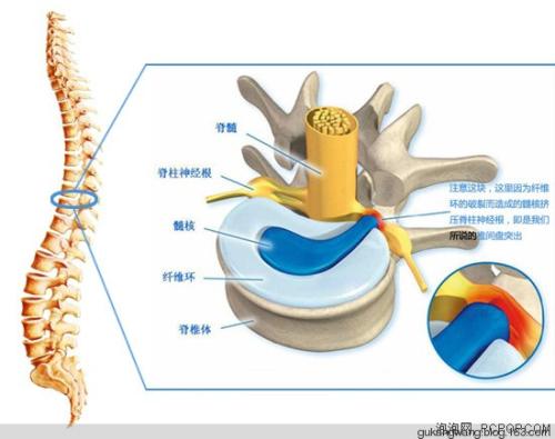 分析中医推拿治疗腰椎间盘突出症的临床可行性