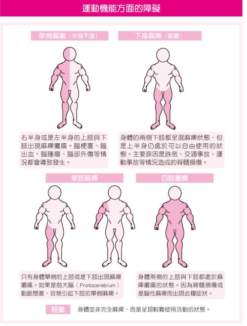脑梗死患者实施早期肢体功能训练的疗效