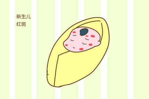 新生儿红斑的治疗方法与护理措施