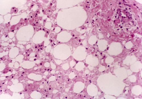 脑组织冰冻切片与石蜡切片免疫组化对比