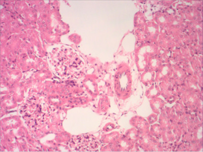 病理切片制作中HE染色技术的运用价值