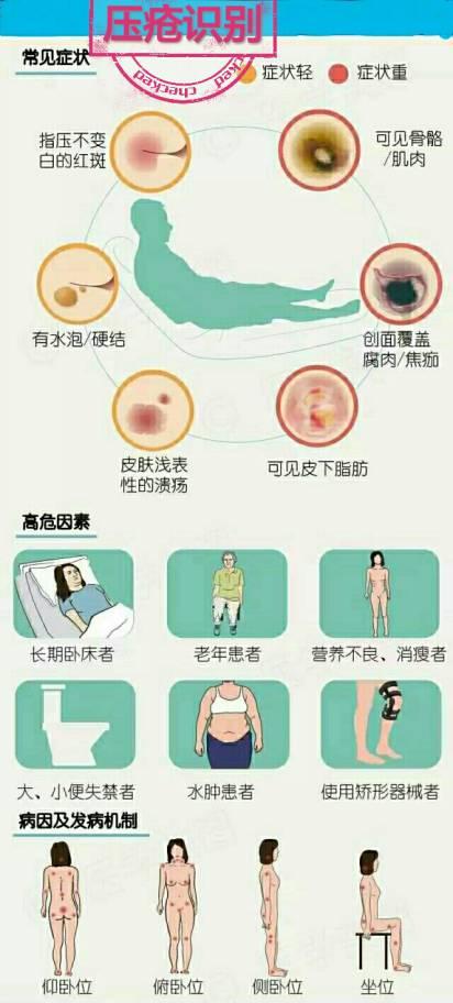 预防护理在压疮患者中的应用价值