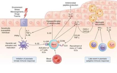 白细胞介素-30在多种炎症及肿瘤中的作用