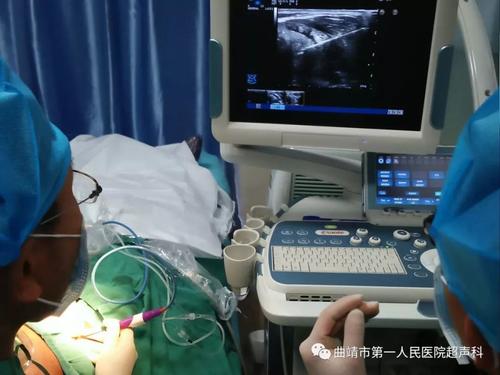 探讨超声科微波消融治疗甲状腺良性结节的临床疗效,有利于四川省医院甲状腺结节的微波消融