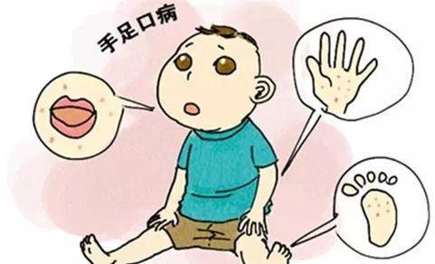 小儿手足口病患儿治疗中综合护理的方法与疗效