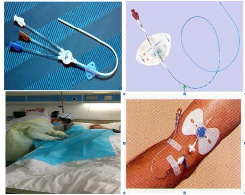 内科患者采用 PICC导管术的效果分析,静脉导管抽取规则