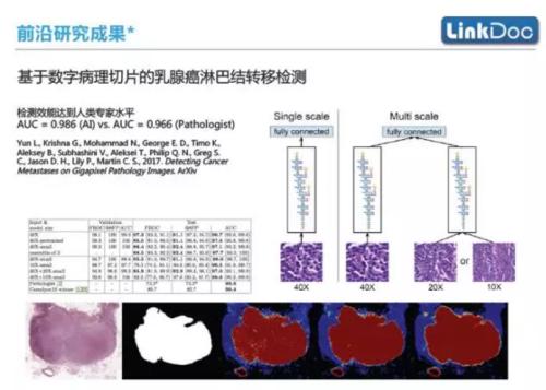 研究临床对乳腺癌病理应用组织学病理学与分子分类的临床诊断意义